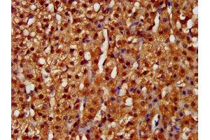 IHC image of ABIN7157812 diluted at 1:200 and staining in paraffin-embedded human adrenal gland tissue performed on a Leica BondTM system. (LARP6 抗体  (AA 294-453))