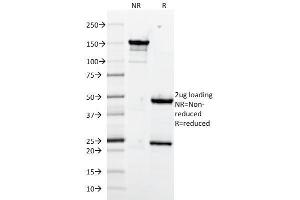 SDS-PAGE Analysis Purified CD106 Monoclonal Antibody (1. (VCAM1 抗体)