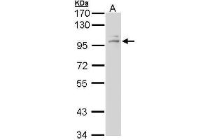 Western Blotting (WB) image for anti-Nuclear Receptor Subfamily 3, Group C, Member 1 (Glucocorticoid Receptor) (NR3C1) (N-Term) antibody (ABIN2854939)
