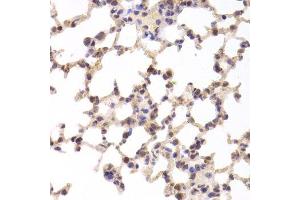 Immunohistochemistry of paraffin-embedded mouse lung using TSC22D3 Antibody. (TSC22D3 抗体  (AA 1-79))