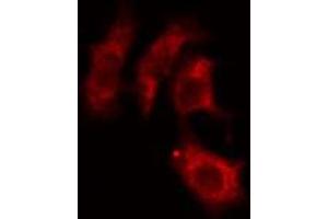 ABIN6274241 staining HepG2 cells by IF/ICC. (ACTN3 抗体  (N-Term))
