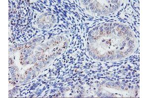 Immunohistochemistry (IHC) image for anti-Hes Family bHLH Transcription Factor 1 (HES1) antibody (ABIN1498636) (HES1 抗体)
