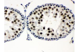 Immunohistochemistry (IHC) image for anti-Menage A Trois Homolog 1, Cyclin H Assembly Factor (Xenopus Laevis) (MNAT1) (AA 92-278) antibody (ABIN3043583)