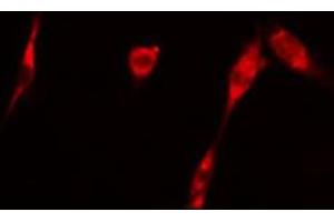 ABIN6266696 staining 293 cells by IF/ICC. (GAK 抗体  (N-Term))