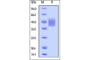 Biotinylated Human CD16b (NA1), His,Avitag (SPR & BLI verified) on  under reducing (R) condition. (FCGR3B Protein (AA 17-200) (His tag,AVI tag,Biotin))