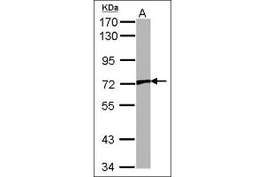 Western Blotting (WB) image for anti-Transient Receptor Potential Cation Channel, Subfamily V, Member 2 (TRPV2) (Ser157) antibody (ABIN615540)