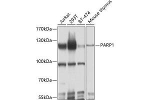 Western blot analysis of extracts of various cell lines, using P antibody (ABIN6134593, ABIN6145233, ABIN6145235 and ABIN6215036) at 1:1000 dilution. (PARP1 抗体  (AA 150-250))