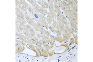 Immunohistochemistry of paraffin-embedded human liver using IGFBP4 antibody at dilution of 1:100 (40x lens). (IGFBP4 抗体)