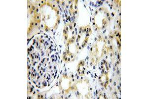 Immunohistochemistry (IHC) image for anti-Tight Junction Protein 1 (TJP1) (AA 1600-1700) antibody (ABIN1513706) (TJP1 抗体  (AA 1600-1700))