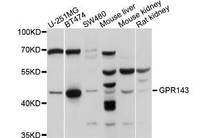 Western blot analysis of extracts of various cell lines, using GPR143 antibody. (GPR143 抗体)