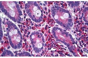 Human Small Intestine: Formalin-Fixed, Paraffin-Embedded (FFPE) (LIM Domain Kinase 1 抗体  (AA 548-648))