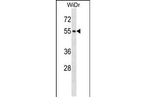 Western blot analysis in WiDr cell line lysates (35ug/lane). (NUP50 抗体  (AA 224-252))