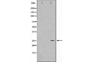 Western blot analysis on HeLa cell lysate using EFNA5 Antibody,The lane on the left is treated with the antigen-specific peptide. (Ephrin A5 抗体  (Internal Region))