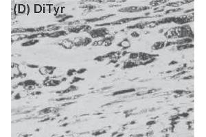 Immunohistochemistry image of dityrosine staining in paraffin section of human atherosclerotic lesion. (Dityrosine 抗体)