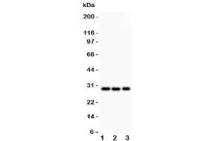 Western blot testing of CSEN antibody and Lane 1:  HeLa