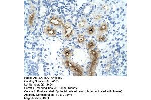 Rabbit Anti-GGTLA4 Antibody  Paraffin Embedded Tissue: Human Kidney Cellular Data: Epithelial cells of renal tubule Antibody Concentration: 4. (GGTLC1 抗体  (C-Term))