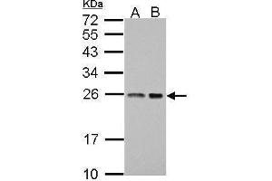 WB Image Sample (30 ug of whole cell lysate) A: A431 B: HeLa 12% SDS PAGE antibody diluted at 1:1000 (BAG2 抗体)
