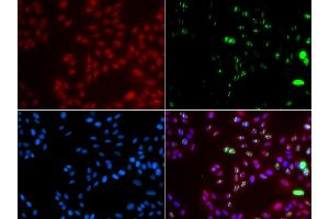 Immunofluorescence analysis of GFP-RNF168 transgenic U2OS cells using XPA antibody. (XPA 抗体)