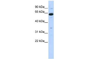 Copine I antibody used at 1 ug/ml to detect target protein. (CPNE1 抗体  (Middle Region))
