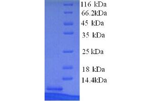 Metallothionein 1X (MT1X) (AA 1-59), (partial) protein (His tag)