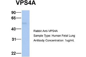 Host: Rabbit Target Name: VPS4A Sample Type: Human Fetal Lung Antibody Dilution: 1. (VPS4A 抗体  (N-Term))