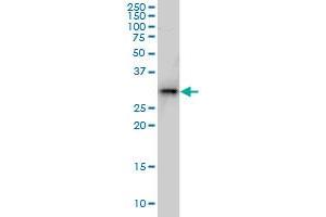 Western Blotting (WB) image for anti-TGFB-Induced Factor Homeobox 2 (TGIF2) (AA 131-236) antibody (ABIN566207)