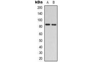Western blot analysis of RAD54A expression in Jurkat (A), HEK293T (B) whole cell lysates. (RAD54L 抗体)