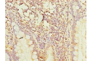 Immunohistochemistry (IHC) image for anti-Polymerase (RNA) III (DNA Directed) Polypeptide A, 155kDa (POLR3A) (AA 392-632) antibody (ABIN7150446)