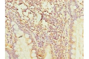 Immunohistochemistry of paraffin-embedded human small intestine tissue using ABIN7150446 at dilution of 1:100 (POLR3A 抗体  (AA 392-632))