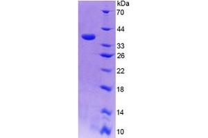SDS-PAGE analysis of Human CISH Protein. (CISH 蛋白)