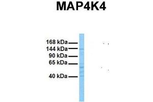 Host:  Rabbit  Target Name:  MAP4K4  Sample Tissue:  Human Stomach Tumor  Antibody Dilution:  1. (MAP4K4 抗体  (N-Term))
