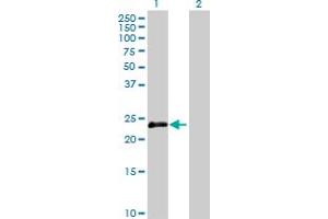 Western Blot analysis of OIP5 expression in transfected 293T cell line by OIP5 MaxPab polyclonal antibody. (OIP5 抗体  (AA 1-229))