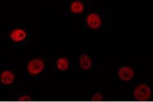 ABIN6274695 staining HuvEc by IF/ICC. (MSH3 抗体  (N-Term))