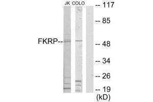 Western blot analysis of extracts from Jurkat cells and COLO205 cells, using FKRP antibody. (FKRP 抗体  (N-Term))