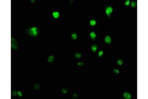 Immunofluorescence staining of U251 cells with ABIN7151309 at 1:100, counter-stained with DAPI. (UHRF2 抗体  (AA 444-585))
