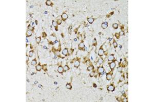 Immunohistochemistry of paraffin-embedded mouse brain using RPN1 antibody. (RPN1 抗体)