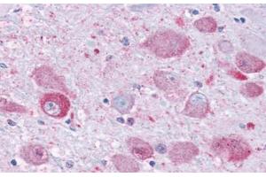 Anti-NPY1R antibody  ABIN1049122 IHC staining of human brain. (NPY1R 抗体  (Cytoplasmic Domain))