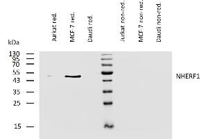 Western blotting analysis of human NHERF1 using mouse monoclonal antibody EBP-10 on lysates of Jurkat, MCF-7, and Daudi cells under reducing and non-reducing conditions.