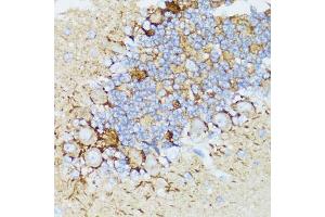 Immunohistochemistry of paraffin-embedded rat cerebellum using NEFH antibody (ABIN5974903) at dilution of 1/100 (40x lens). (NEFH 抗体)
