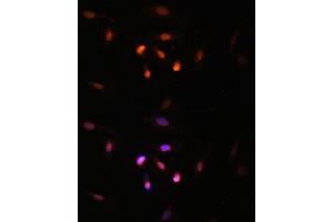 Immunofluorescence analysis of U2OS cells using KA antibody (ABIN7268768) at dilution of 1:100. (MYST3 抗体  (AA 800-1000))