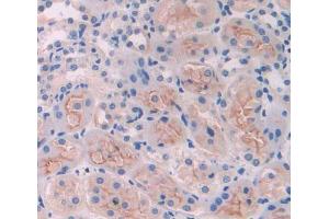 Used in DAB staining on fromalin fixed paraffin- embedded kidney tissue (CLTA 抗体  (AA 5-234))