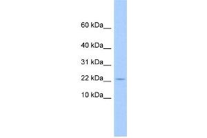 WB Suggested Anti-C10orf132 Antibody Titration: 0. (GOLGA7B 抗体  (N-Term))