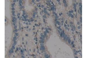 Immunohistochemistry (IHC) image for anti-Arachidonate 12-Lipoxygenase (ALOX12) (AA 352-656) antibody (ABIN7440719)
