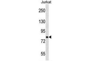 CACNB2 Antibody (Center) western blot analysis in Jurkat cell line lysates (35µg/lane). (CACNB2 抗体  (Middle Region))