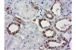 Immunohistochemistry (IHC) image for anti-Beclin 1, Autophagy Related (BECN1) antibody (ABIN1496866) (Beclin 1 抗体)
