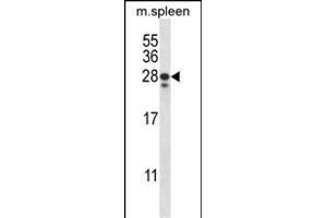 ANKRD22 Antibody (C-term) (ABIN657584 and ABIN2846587) western blot analysis in mouse spleen tissue lysates (35 μg/lane). (ANKRD22 抗体  (C-Term))