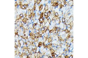 Immunohistochemistry of paraffin-embedded rat ovary using J Rabbit mAb (ABIN7268036) at dilution of 1:100 (40x lens). (JAK1 抗体)