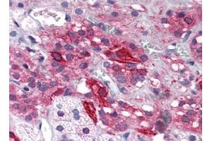 Human Adrenal (formalin-fixed, paraffin-embedded) stained with GRIK1at 5 µg/ml followed by biotinylated goat anti-rabbit IgG secondary antibody, alkaline phosphatase-streptavidin and chromogen. (GRIK1 抗体  (Center))