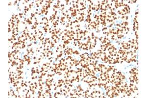 Immunohistochemistry (IHC) image for anti-Paired Box 8 (PAX8) (AA 60-261) antibody (ABIN6940923)