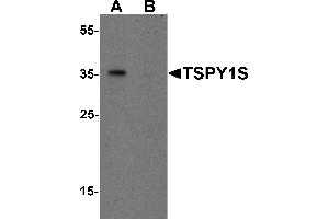 Western Blotting (WB) image for anti-TSPY1S (C-Term) antibody (ABIN1077409) (TSPY1S (C-Term) 抗体)